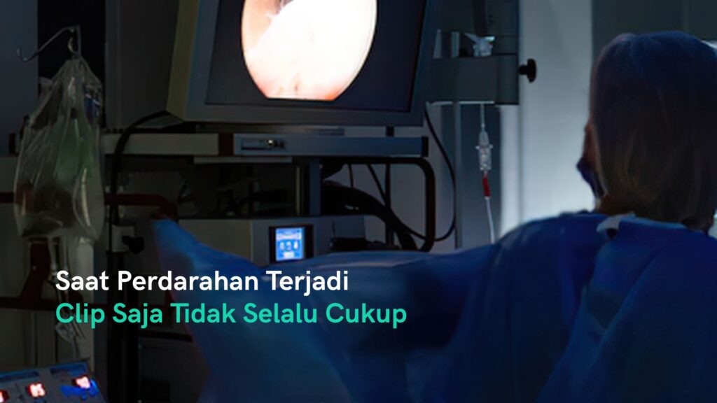Saat Perdarahan Terjadi, Clip Saja Tidak Selalu Cukup