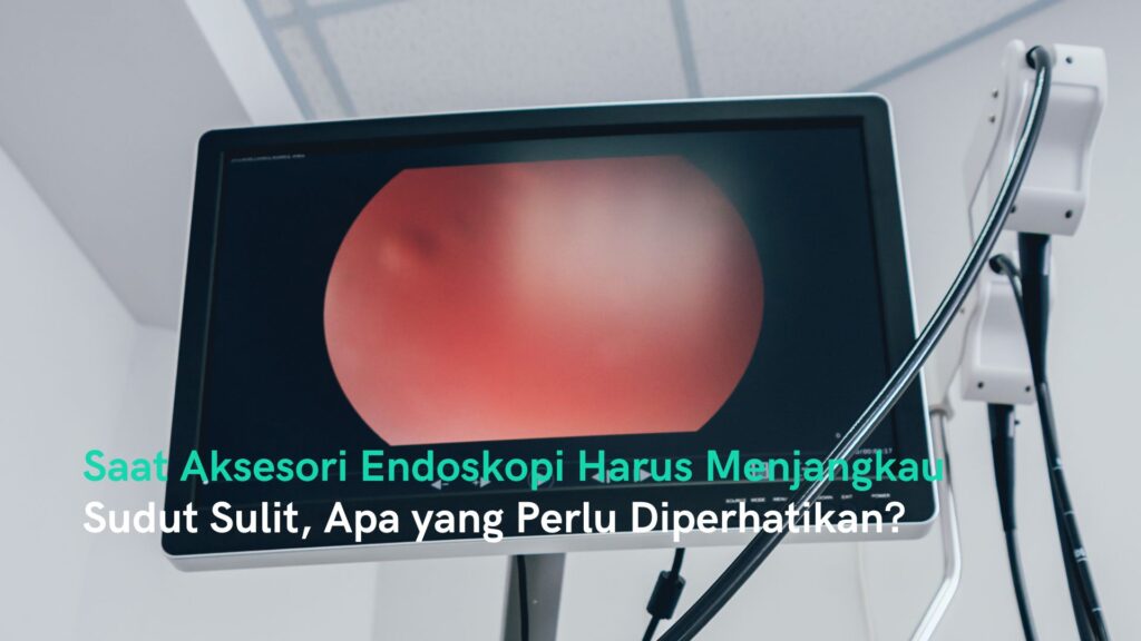 Aksesori Endoskopi untuk Sudut Sulit: Apa yang Perlu Diperhatikan?