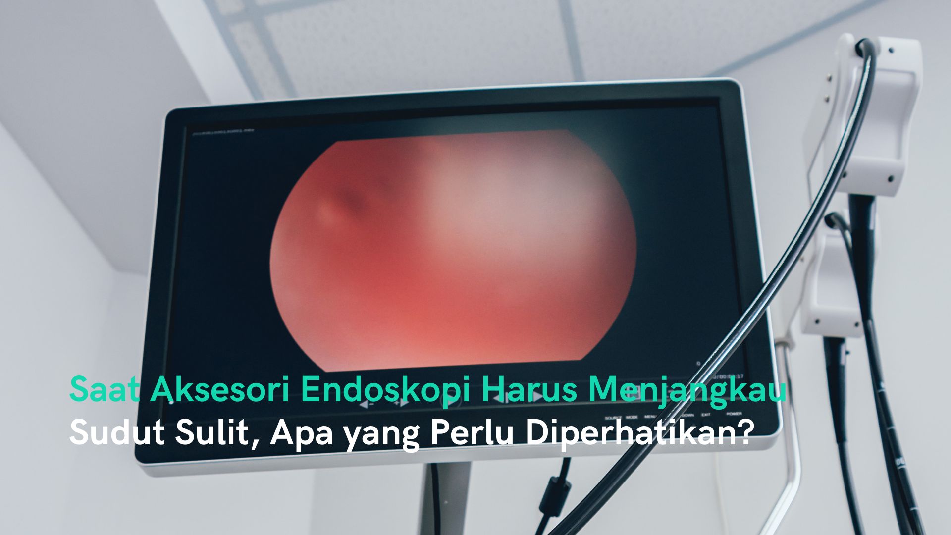 Aksesori Endoskopi untuk Sudut Sulit: Apa yang Perlu Diperhatikan?